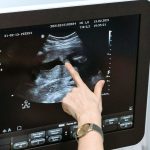 Η Ευρώπη στη δίνη της συζήτησης για τις αμβλώσεις: Η Διεθνής Αμνηστία προειδοποιεί - FinanceNews.gr