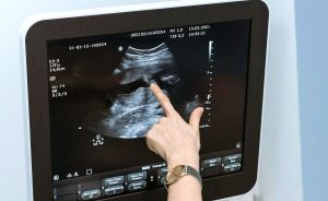 Η Ευρώπη στη δίνη της συζήτησης για τις αμβλώσεις: Η Διεθνής Αμνηστία προειδοποιεί - FinanceNews.gr