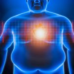 Παχυσαρκία: Σχετίζεται με περισσότερα από 60 νοσήματα - FinanceNews.gr